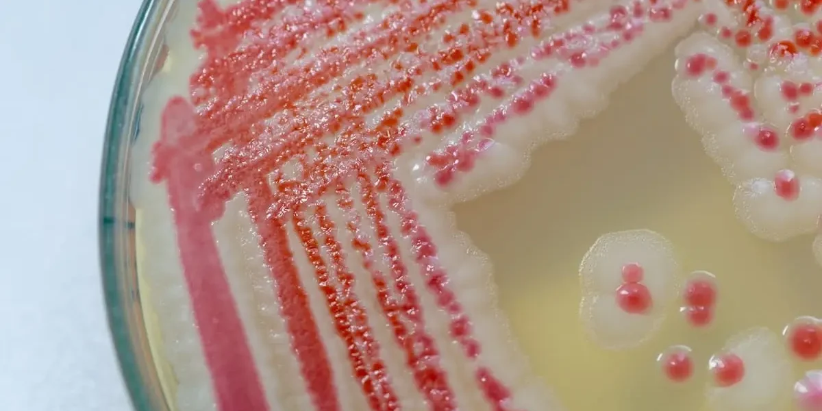 Pink Mold - Serratia Marcescens